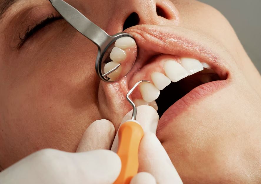 dental-care